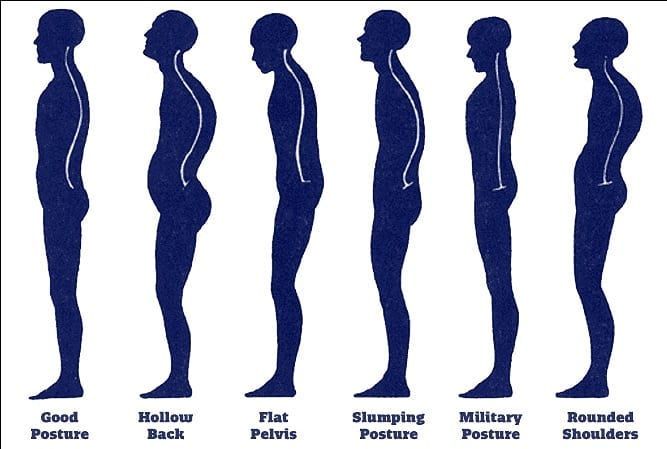 Therapy Works on X: Why you #slouch You have different #muscles