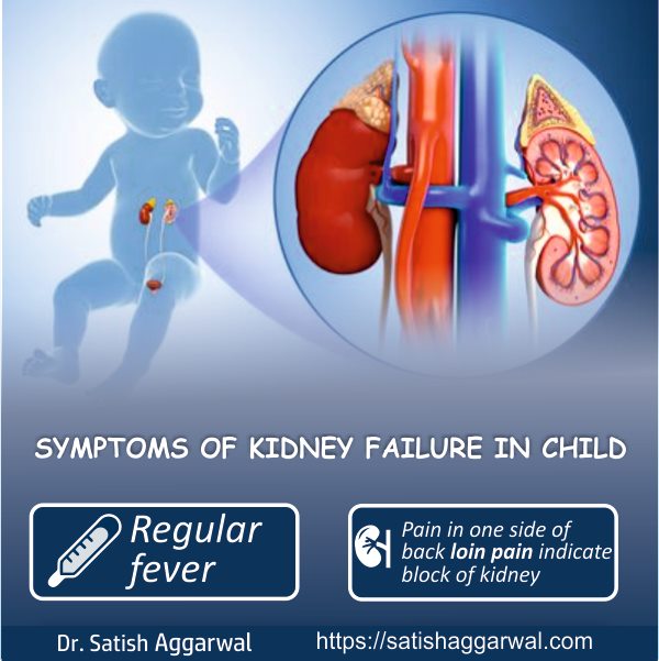 #Symptoms of #kidney #Failure in #child 
- Regular #Fever 
- Pain in One Side of back is called #LION #PAIN IndIcate block of kidney 
@nkf @sgrhindia @MoHFW_INDIA @Childhealthchat @NHPINDIA @PediatricSurge @ChildSurgery_V1 @indiachildren #mondaythoughts 
satishaggarwal.com