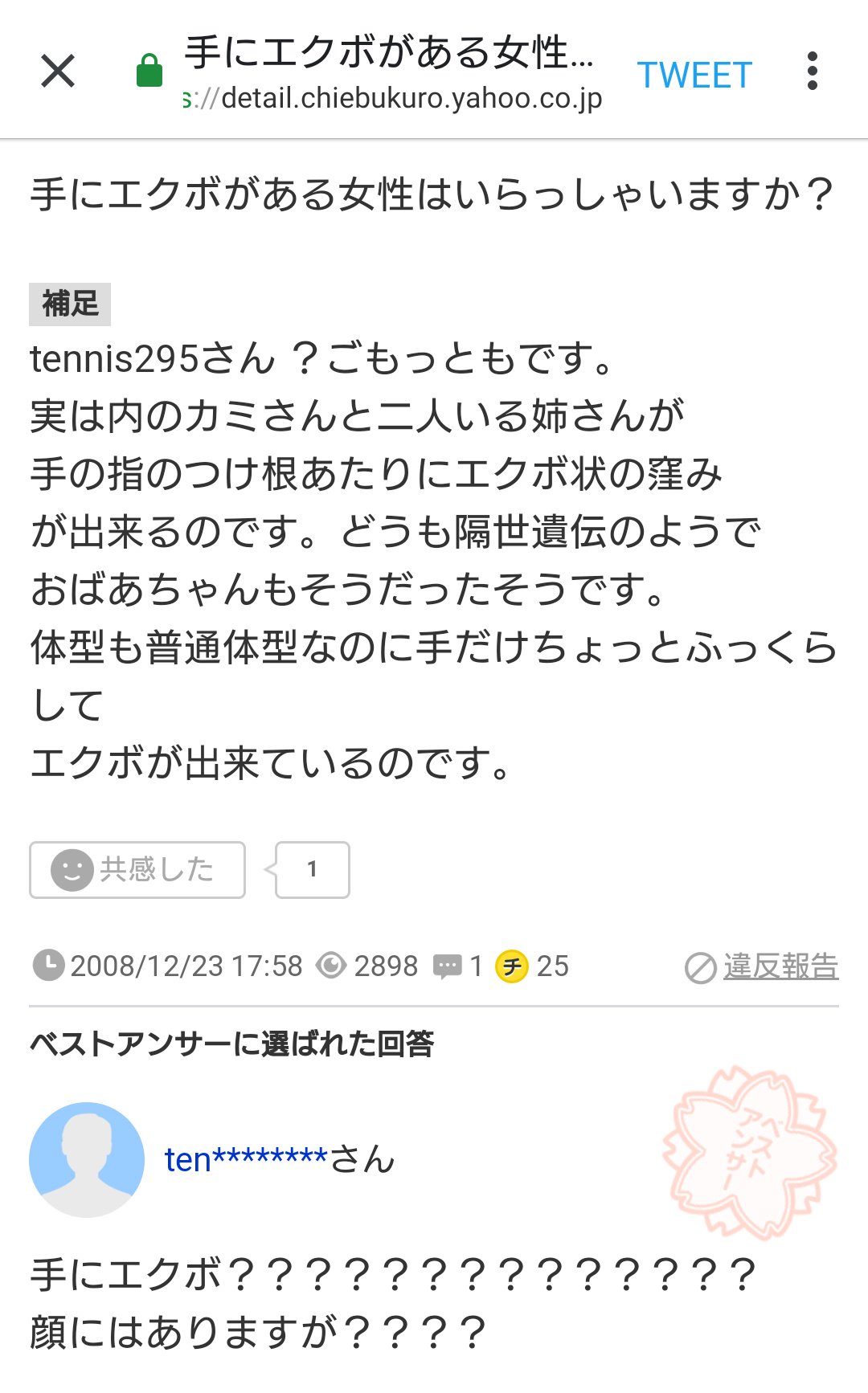 マミーチャン 大人になったら手に骨や筋が浮かぶと思っていたんだけど マミーおばあチャンはずっとエクボが出来るクリームパンの手をしているので ネットで手を検索したけどやはり綺麗に骨が浮き出てる手ばかりで そしたらこんな質問見つけた え これ