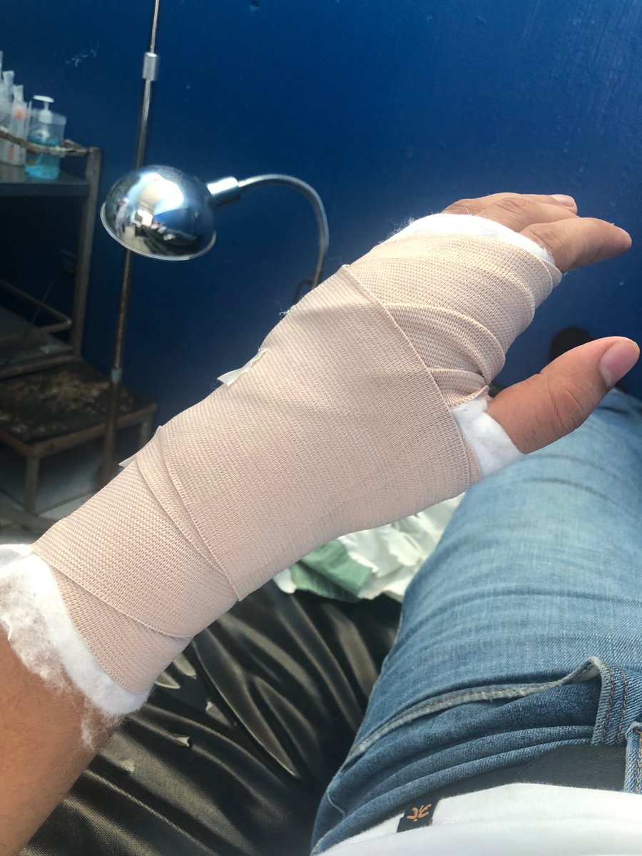 asuchini's tweet photo. Me operaron de mi mano y quería saber de algún deck sin skill que me recomienden que pueda jugar con una mano/nepe o algún ninja que sepa jutsus de curación es también bienvenido, gracias. https://t.co/x99xaYs1l8