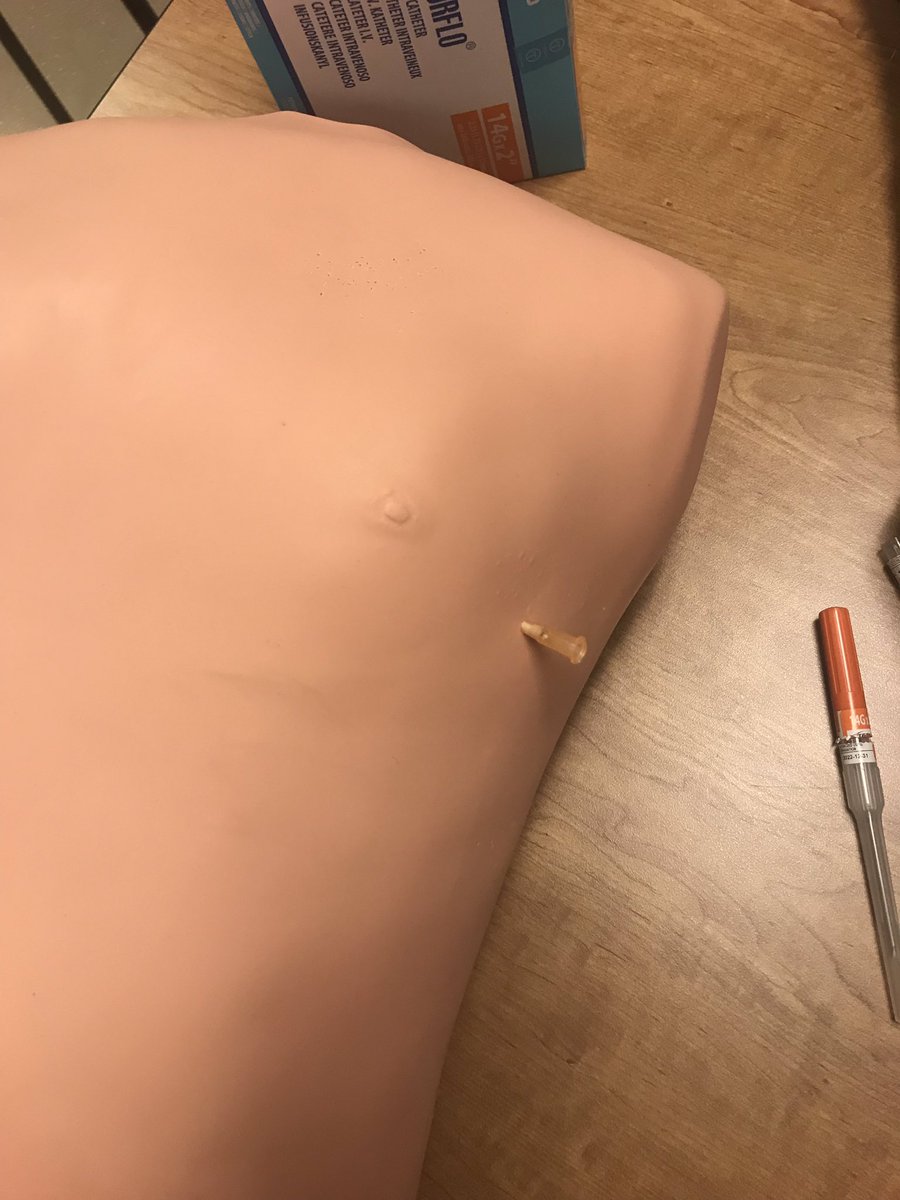 Station 5 - poly-trauma! All about BLS. ABCDE or MARCH? Which algorithm is better? Stop massive hemorrhage with tourniquet and manage ABC’s simultaneously. Decompress PTX in AAL for higher chance of success. Rapid transport, but reverse life threats first!  #EMS  #FOAMems6/x