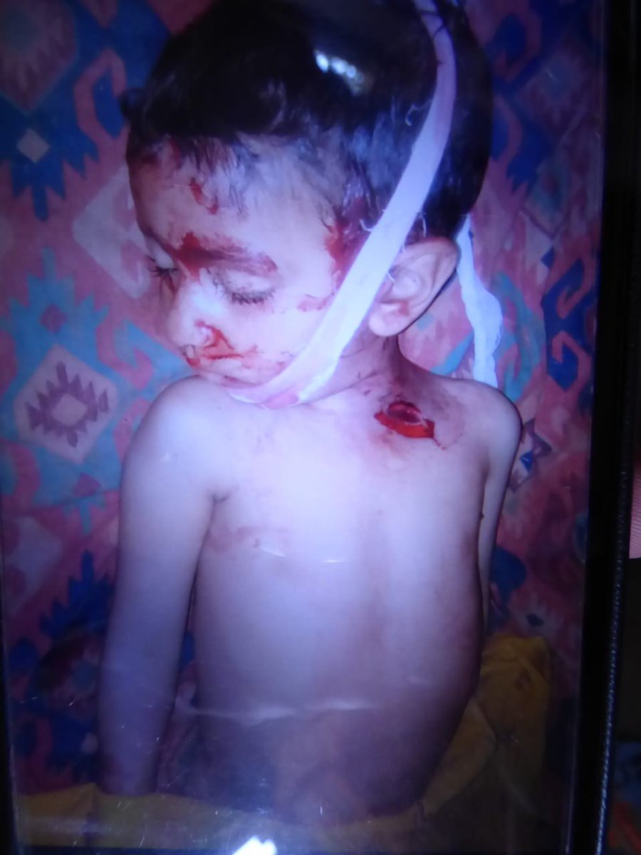 Qadir1Rai's tweet photo. The civilized🌍kept watching,PAK became silent spectacle & Kashmir's blood disgraced.
REMEMBER!
Whether,PAK govt,chooses peace& whole world opposes us.
But,Pakistanis'll fight till the last breath.We'll make all sacrifices.
We'll fight 2 live& die 2 survive
#ModiKillingKashmiris https://t.co/rQVZWAlrjy