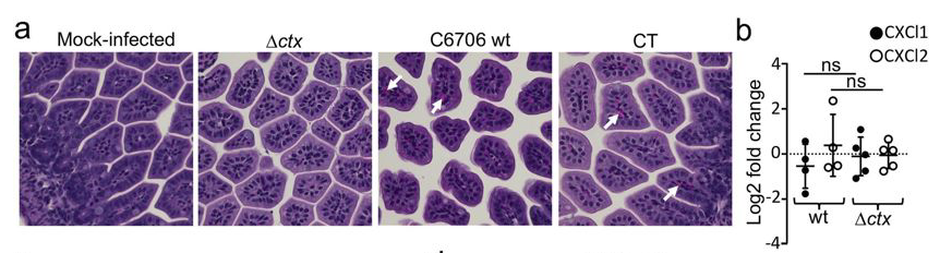 mmw_lmw's tweet photo. #Vibrio_cholerae Infection | #CholeraToxin promotes pathogen acquisition of host-derived haem and fatty acids | John Mekalanos @harvardmed @Nature https://t.co/gpzHEsOnIu https://t.co/t9rnS5PRxf