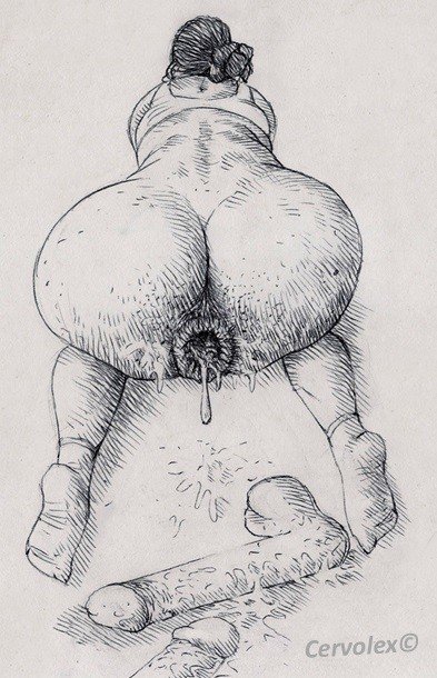 Anal Prolapse Cartoon - Cervolex on X: \