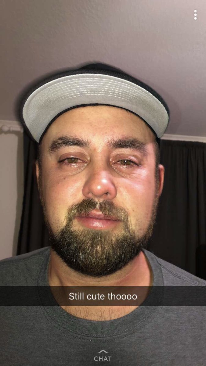 appylee123's tweet photo. @TheLifeOfLane @WoodsDiesel He started the night so strong and ended it by smiling through the pain. #gusstrong https://t.co/XyKy88lq5z