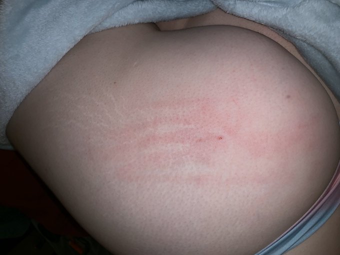 Mama likes it rough 🤤 https://t.co/bD2lfL5rBP<a href="/tag/thiccwhitegirl"class="tags"><span>#thiccwhitegirl</span></a><a href="/tag/followforthiccsex"class="tags"><span>#followforthiccsex</span></a>