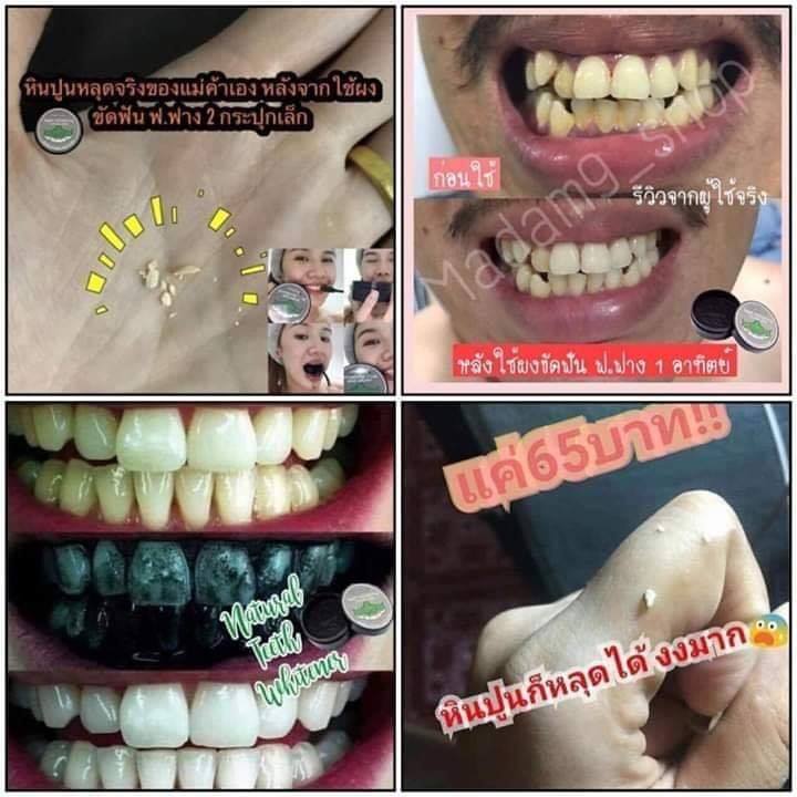 pp_mmmm_nn's tweet photo. #บริการปลายทาง
สูตรเด็ด !!! ทำแล้วได้ผลจริง😁😁
#ฟันเหลืองกลายเป็นฟันขาว #คราบหินปูนหาย 
#แก้ปากเหม็น #แก้เหงือกอักเสบ 
มี 2 ขนาด
👉กระปุกเล็กขนาด 5  กรัม 65 ฿ ใช้ได้ 2-3 สัปดาห์
👉กระปุกใหญ่ขนาด 30 กรัม 250 ฿ ใช้ได้ 3-4เดือน

📌#พร้อมส่ง https://t.co/Jxv1IWUoVQ