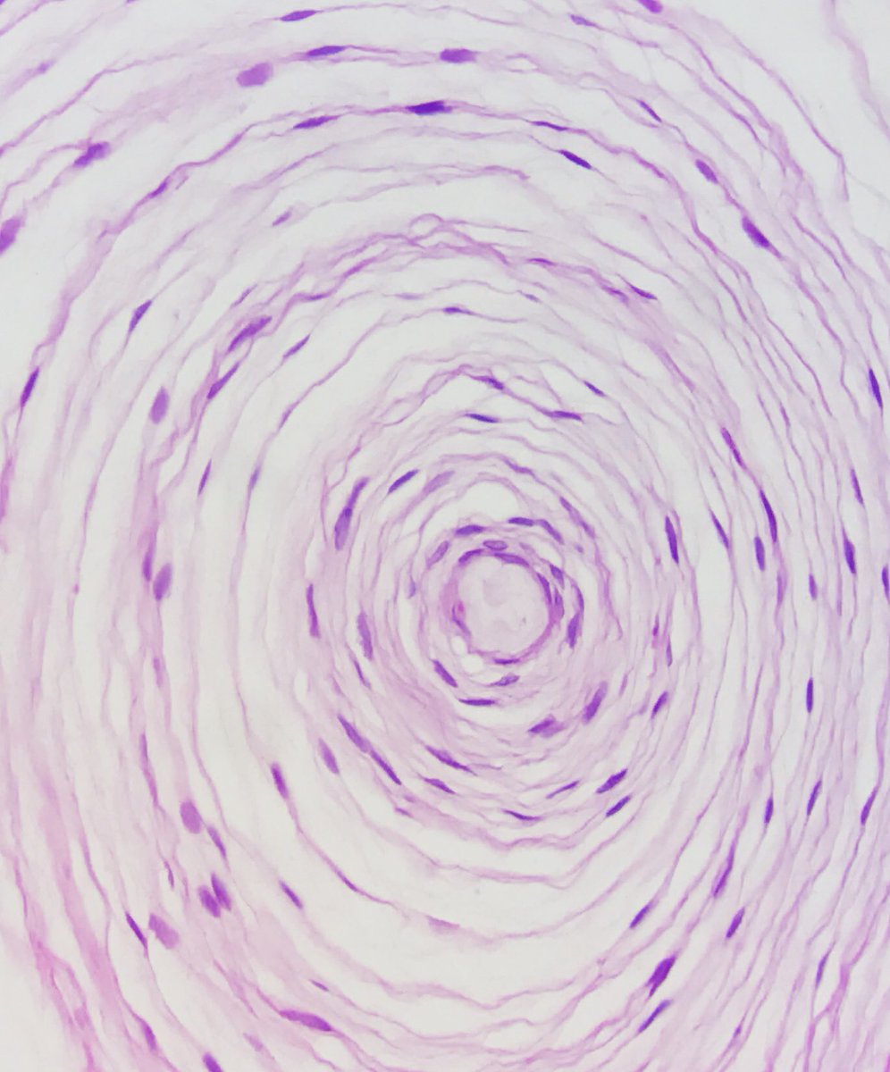 LizaAriasT's tweet photo. #CorpúsculoDePacini #PacinianCorpuscle
Nerve endings. Mechanoreceptors sensitive to vibration and pressure
#Dermatóloga #Dermatologist #Dermatology #Dermatopathology #Dermatopathologist #PathArt #LovingDermPath https://t.co/b7MhpaHvTI