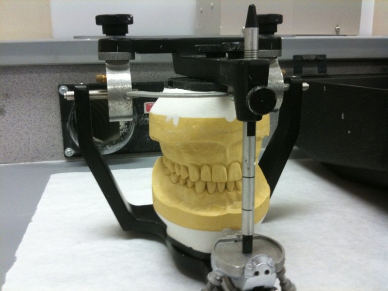 psdivya1267's tweet photo. An #articulator is a mechanical device used in #dentistry to which casts of the maxillary &amp; mandibular #teeth are fixed, reproducing recorded positions of the mandible in relation to the maxilla.
Exciting opportunity is waiting for you https://t.co/yS1Z97Qn73

#dentalimplants https://t.co/aNFbjV3Peg