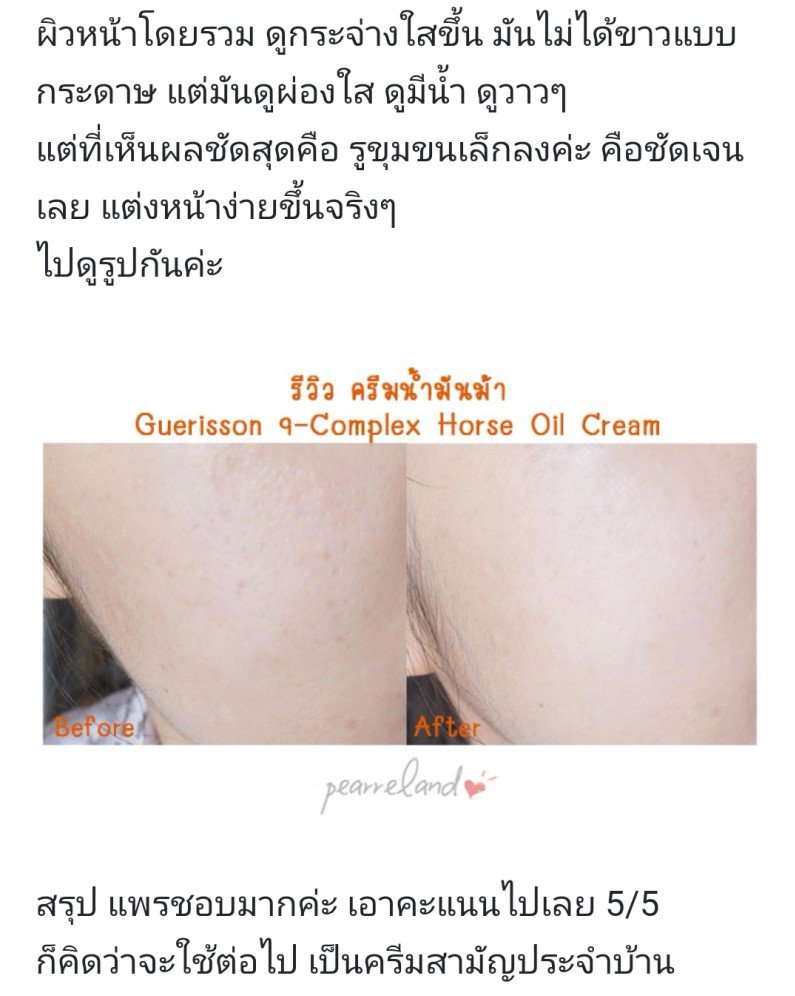 numjshop's tweet photo. #Guerisson 9 Complex ของแท้ 100%
🌺ดูแลปัญหาผิวที่เป็นสิวลดอาการอักเสบบวมแดง ลดอาการแพ้ ลดเลือนจุดด่างดำฝ้า กระ ลดเลือนแผลเป็นบนผิวหนัง และรอยผิวเปลือกส้ม ให้ค่อยๆ จางลง
📣 450฿
#ใช้ดีบอกต่อ #ของมันต้องมี #ของดีบอกต่อ #ส่งต่อสกินแคร์ #สกินแคร์เกาหลี #ถูกและดี #ครีมแต้มสิว https://t.co/AyqSs3QMor