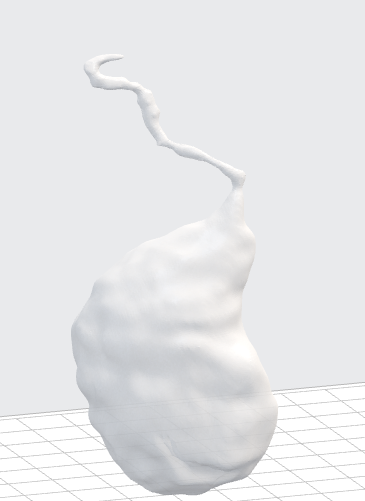 3d_maranon's tweet photo. The following case corresponds to the modelling of a carotid aneurism. The aim of this 3D representation will help endovascular surgeons find the optimal pathway to reach the aneurism. FabLab team: @rupermac  @calvoharo_ja @diegotrap @AbyAmselem @kn_ord. https://t.co/mvnIV6gWZi