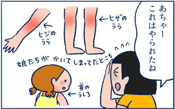 #とびひ
って…頭に広がることもあるんですね…😱
(@komamenomame)さんの娘さんの体験談です
▼体中にとびまくり、最後は丸坊主の危機に!?
https://t.co/nalMTAipqN
#予防は皮膚にできるだけ傷をつけないこと
#虫刺されなどは掻かないように注意