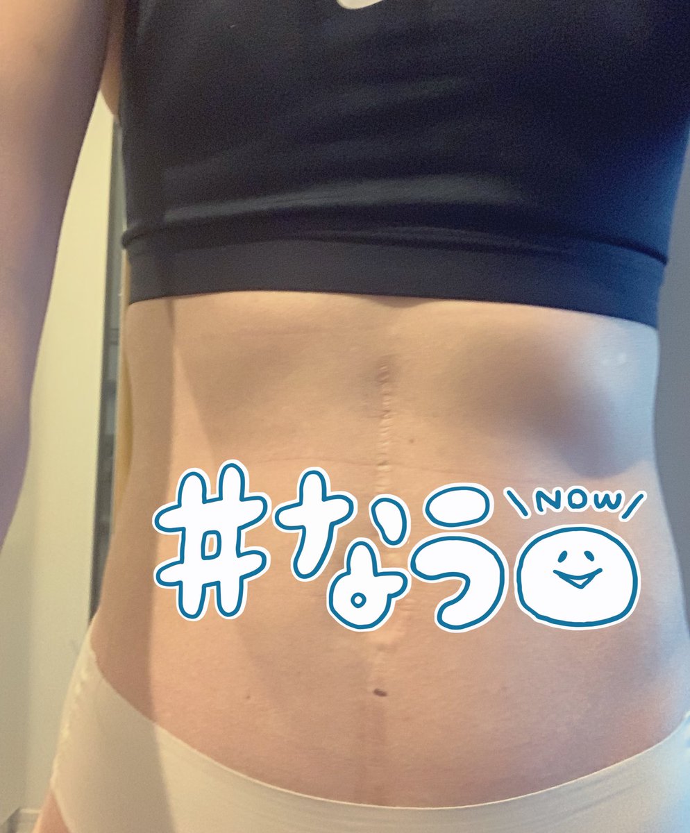 Avainsana 帝王切開じゃないよ Twitterissa Avainsana 帝王切開じゃないよ Twitterissa