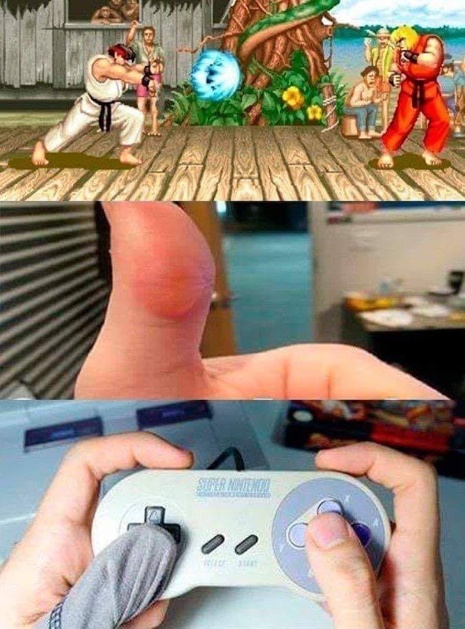 SoyFedelobo's tweet image. Dolor del bueno 🎮