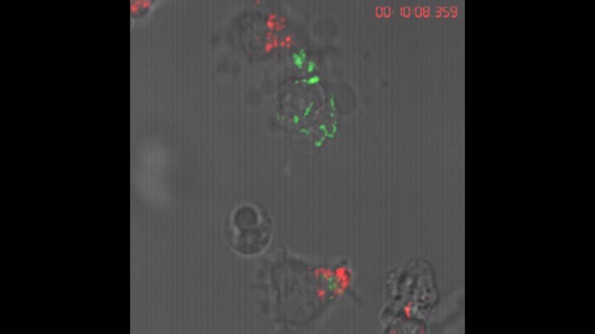 10Things_ToKnow's tweet image. Investigating the links between obesity and the immune system. @AndyHogan82 @MaynoothUni explains to @jonathan_mccrea how #NKcells in people of a healthy weight annihilate tumor cells. 🦸‍♀️👊🦹‍♂️@10Things_ToKnow - series 5, RTÉ One, November. #LoveIrishResearch #flowcytometry