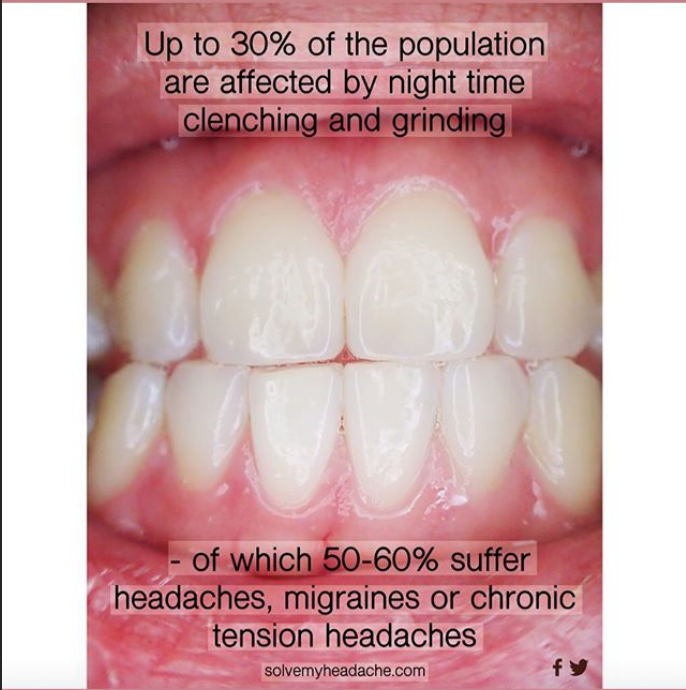 solvemyheadache's tweet photo. Did you know this? If you suffer from nighttime teeth clenching or grinding, get in touch 👌🏻 #solvemyheadache #bruxism #migraine #headache https://t.co/MdwK3CDWEz