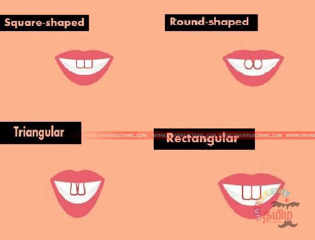 universalthamil's tweet image. இதில் உங்க பல்லின் வடிவம் எதுனு சொல்லுங்க? நீங்க எப்படினு நாங்க சொல்றோ… #teeth #teethshape #முக்கோணவடிவபற்கள் #ut #utlifestyle #tamilnews #universaltamil universaltamil.com/%e0%ae%87%e0%a…