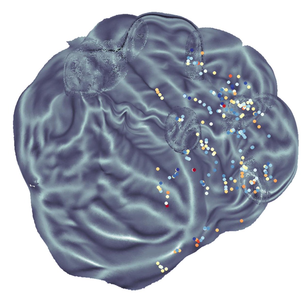 my sEEG 'trodes look OK, but something wrong with my #pycortex