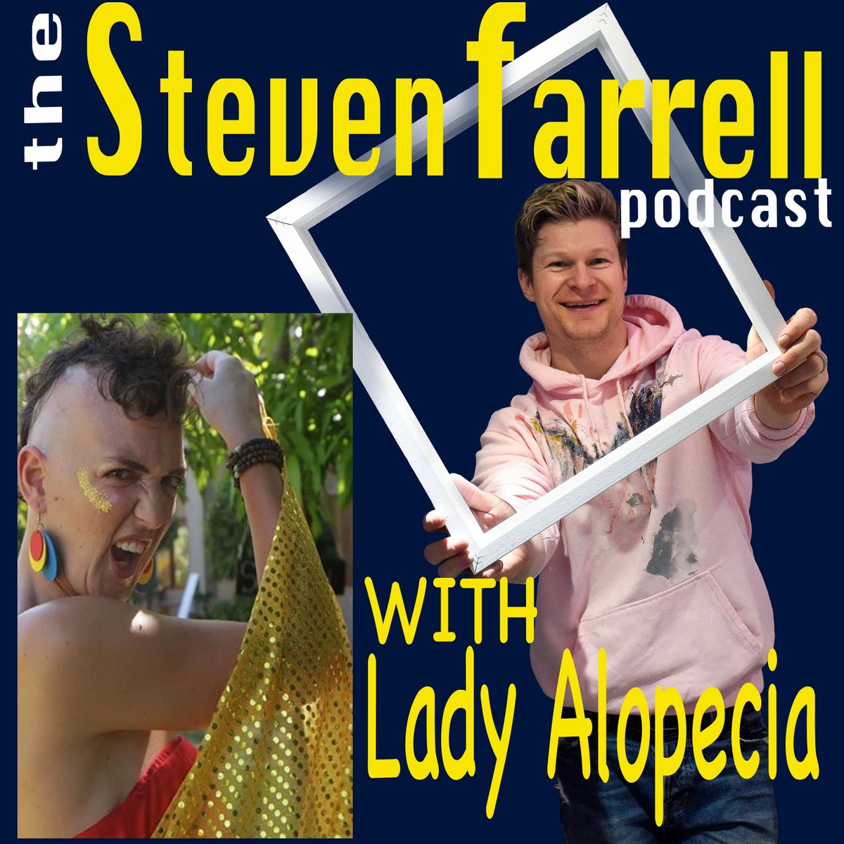StevenFarrellPC's tweet photo. https://t.co/GbpKBoxz6p #Alopecia https://t.co/u9QQi8AUFy
