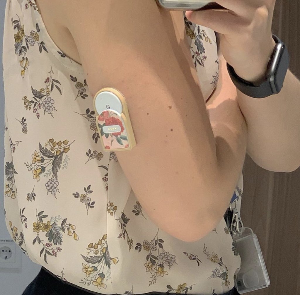 High_Brilliant_'s tweet photo. @royerceci 
#freestylelibre #abbotfreestylelibre #t1diabetes #t1d #t1dlookslikeme #type1diabetic #typ1d #type1 #typeone #typeonekids #typeonediabetes #diabeauty #diabetes #diabeteslife #t2d #type1strong #miaomiao_smart_libre_reader https://t.co/8vBlKn6UoM