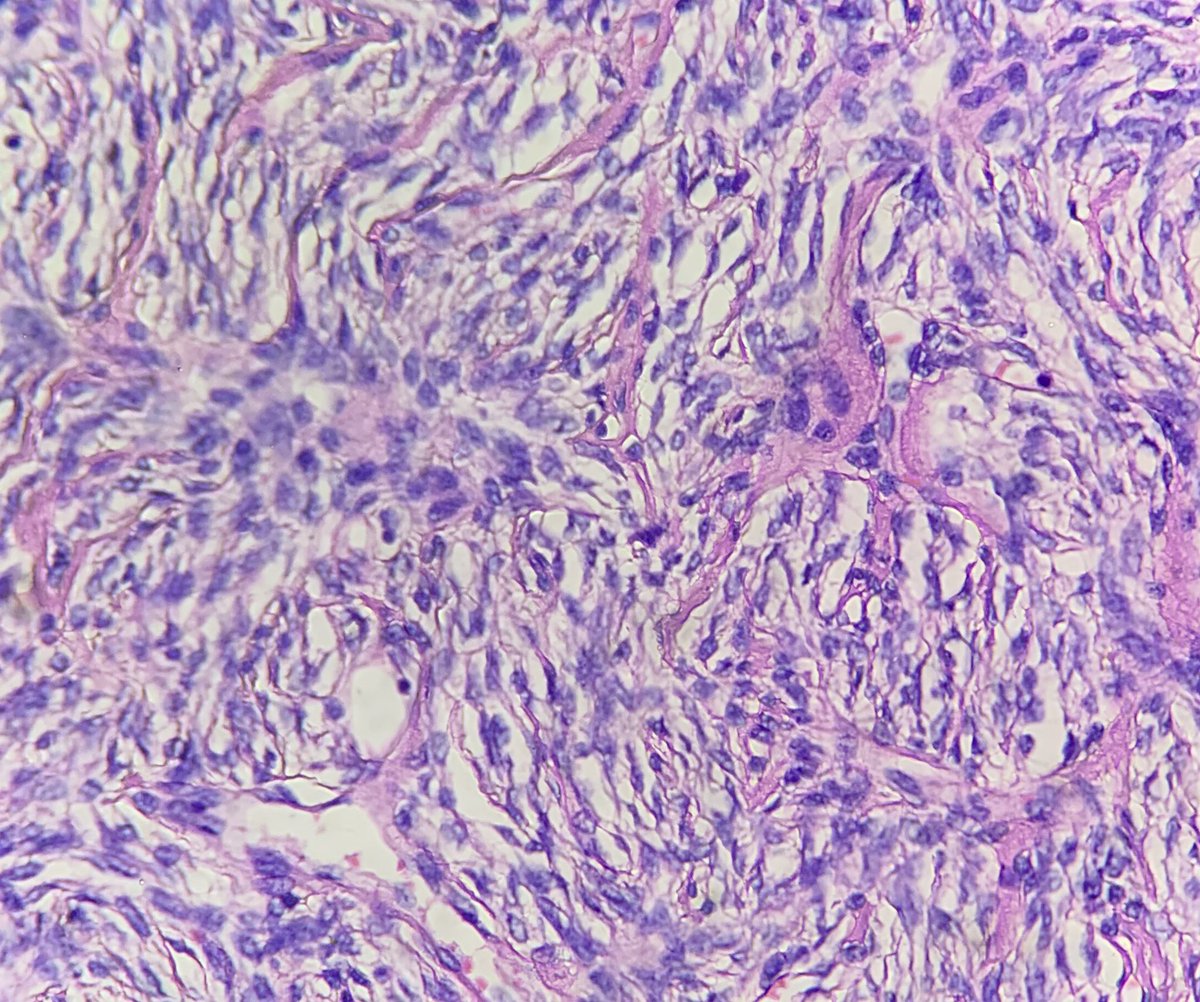 AyeWonn's tweet photo. Male breast lump, your diagnosis? https://t.co/E75jTqdltd