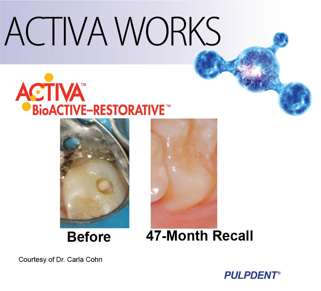 PulpdenTweets's tweet photo. #ACTIVAWORKS Courtesy of Carla Cohn https://t.co/WfsZs7Wy6U