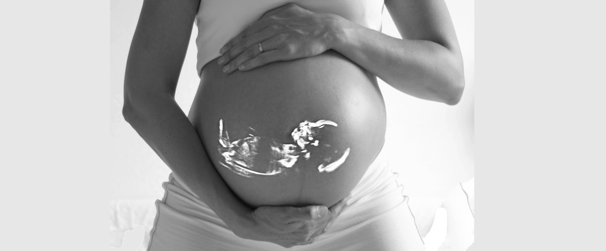 PLOSMedicine's tweet photo. Today, we are pleased to publish the first articles into our #Maternal and #ChildHealth &amp; #Nutrition Special Issue! Stay tuned throughout August as we release new #research into the collection - and you can always find them all right here:
https://t.co/VQQcySLc4A https://t.co/AfXlmbPCKp
