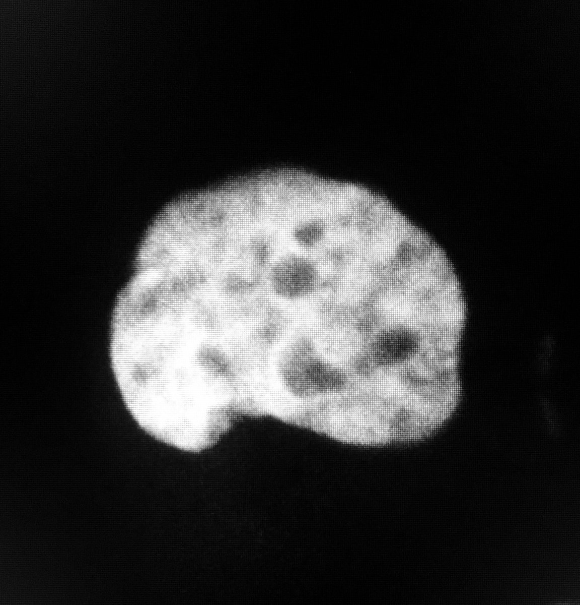 KarlaVV_TM's tweet image. When your cell smiles at you to cheer you up .... after you destroyed your IF in the last step 😂😭🔬 #DAPI