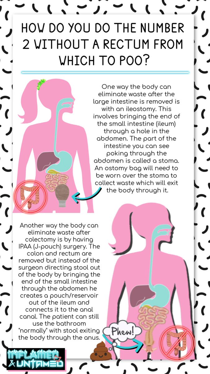 SaraRingerSharp's tweet image. 1/3 All about the #jpouch. Created these yesterday and posted them on my instagram highlights but thought you guys would like to see them too. As always feel free to share but please do not edit/alter them. See full thread for all images.