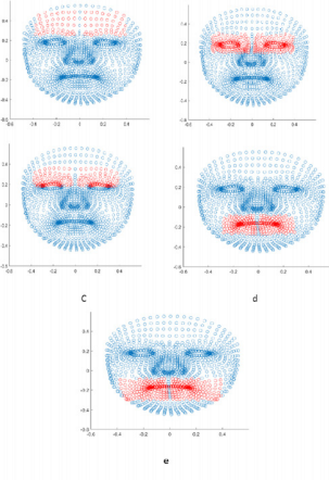 Biomedres01's tweet photo. #OutcomePrediction of Bell’s Palsy by Kinect II by Filip Caisberger, Olřich Vysata* in #BJSTR
https://t.co/8tW6ueViee https://t.co/LFUMl2JehC