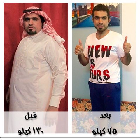 0Marya1's tweet photo. #حٍسًاًبٍ_اًلٍمًوًاُطٍن
مع   كليٍن 9  ��نت غير

🌹مجَموَعۂ ڪڵيّنٌ  💪 عڵيّ قَݚ ٱيّݚڪ🌹

راح تخسر 15 كيلو في 21 يوم💪 

خالي من اي اثآر جانيه 

متابعه يومية طوال الكورس

للطلب الواتس اب 👈الرابط بأول تعليق👇 https://t.co/Kfo0SbGFy2