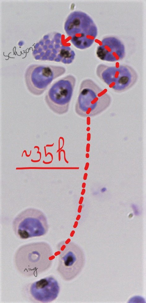 Richards_Lab's tweet photo. Nice combination of asynchronous #3D7 #malaria parasites on a #Giemsa stained thin smear allows us to trace in red the 'journey' that the ~10h #ring form of the parasite will do until he graduates as a #schizont! @BurnetInstitute @BurnetMalaria https://t.co/eFM8UgpUZn