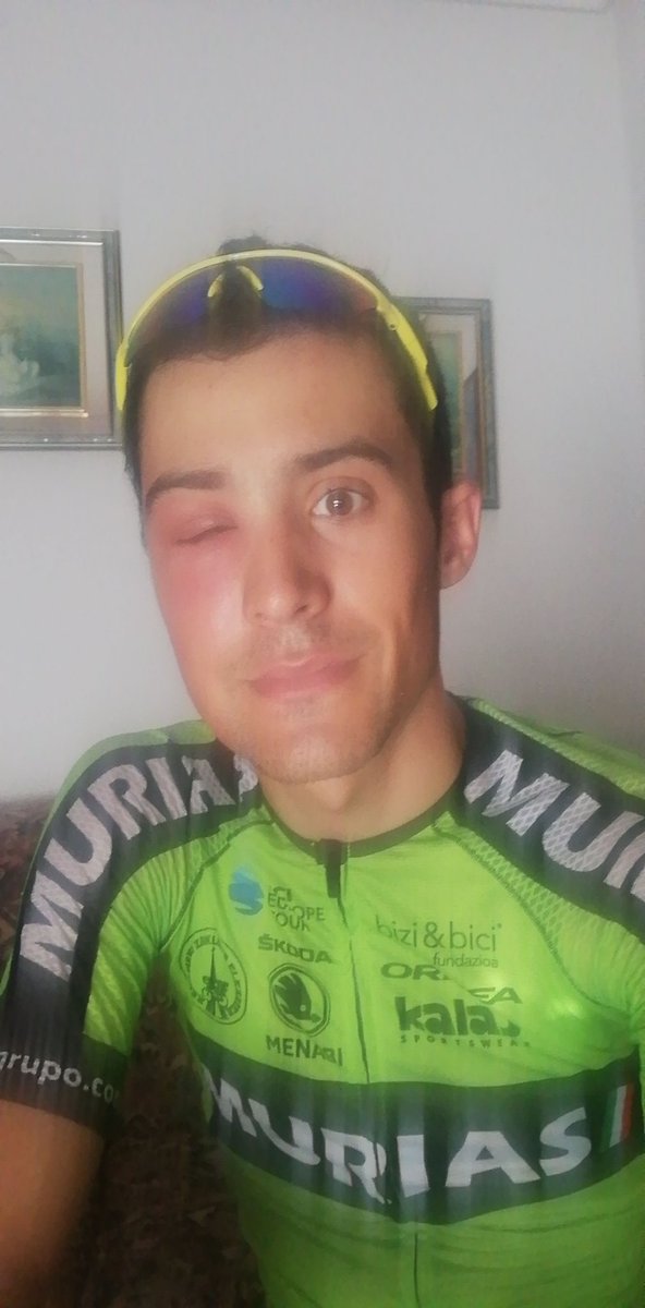 Ayer me pico una 🐝 en el ojo mientras entrenaba.
Ahora no veo y evidentemente no me puedo tomar la medicación correcta ( leyes del ciclismo) y tengo que tratarlo a base de hielos, pomadas( no todas valen) dolor y paciencia.
¿Hasta que punto velan por la seguridad del ciclista?