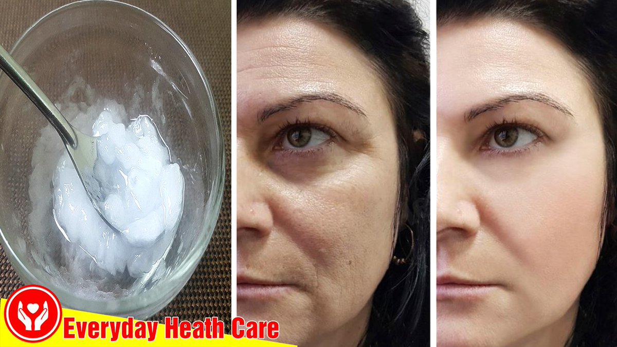 EverydayHeath's tweet photo. How to Wash Your Face and Say Goodbye to Sagging Facial Skin and Wrinkles
Click link for more details:
https://t.co/F5cSOzDnuU
#Everydayhealthcare
#Getridofwrinklesonface
#Howtotightenskinonface
#Beautytips
#Skincaretips https://t.co/kxhKqR9JsU