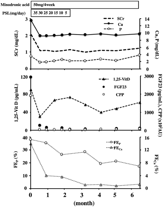 CKJsocial's tweet image. Calciprotein particles and fibroblast growth factor 23 contribute to the pathophysiology of #hypercalcemia in a patient with renal #sarcoidosis buff.ly/2GPoatd