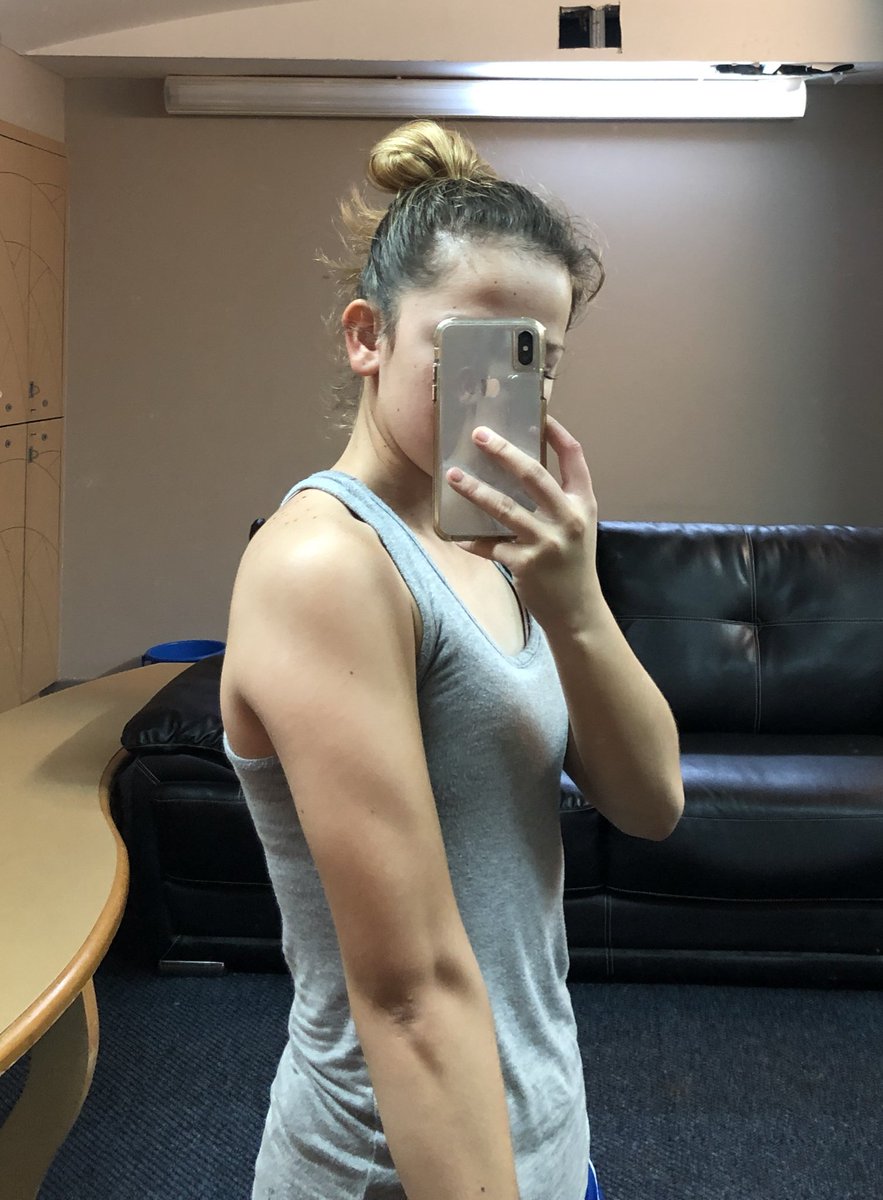 sammyfegurgur's tweet photo. hi these pics are 5 months apart and i ik it doesn’t mean anything but i’d just like to share my progress 🏋🏽‍♀️🥰 #swolesa https://t.co/0shjWT0yuy