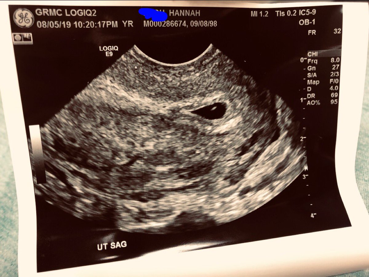 Sooo it happened 😂