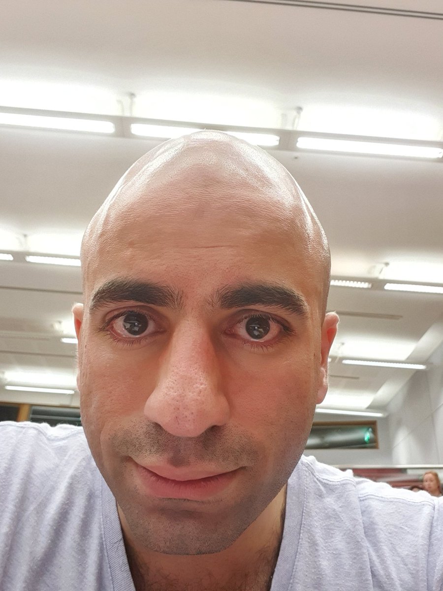 ahmedhankir's tweet photo. Too vulnerable?

13 years ago I experienced a debilitating episode of mental illness

I was stigmatised, dehumanised &amp; marginalised

In despair I was hopeless &amp; suicidal

Today

I'm an Academic Clinical Fellow in Psychiatry with South London &amp; Maudsley

These are my tears of joy https://t.co/HUr31j2ZGv
