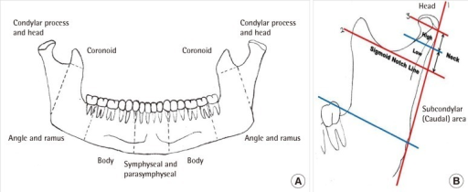 swostik_devkota's tweet photo. CONDYLAR FRACTURE AND ITS MANAGEMENT https://t.co/lqByjNURwC https://t.co/EbRG0JVnOU