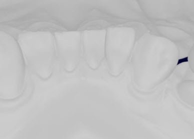 TootyVr's tweet photo. #orthodontie en Réalité Virtuelle #Dental #VR #TootyVR https://t.co/pPtPlUzIeK