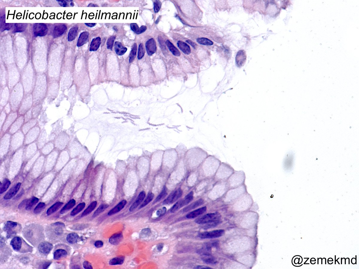 GI/Liver Path tweet media