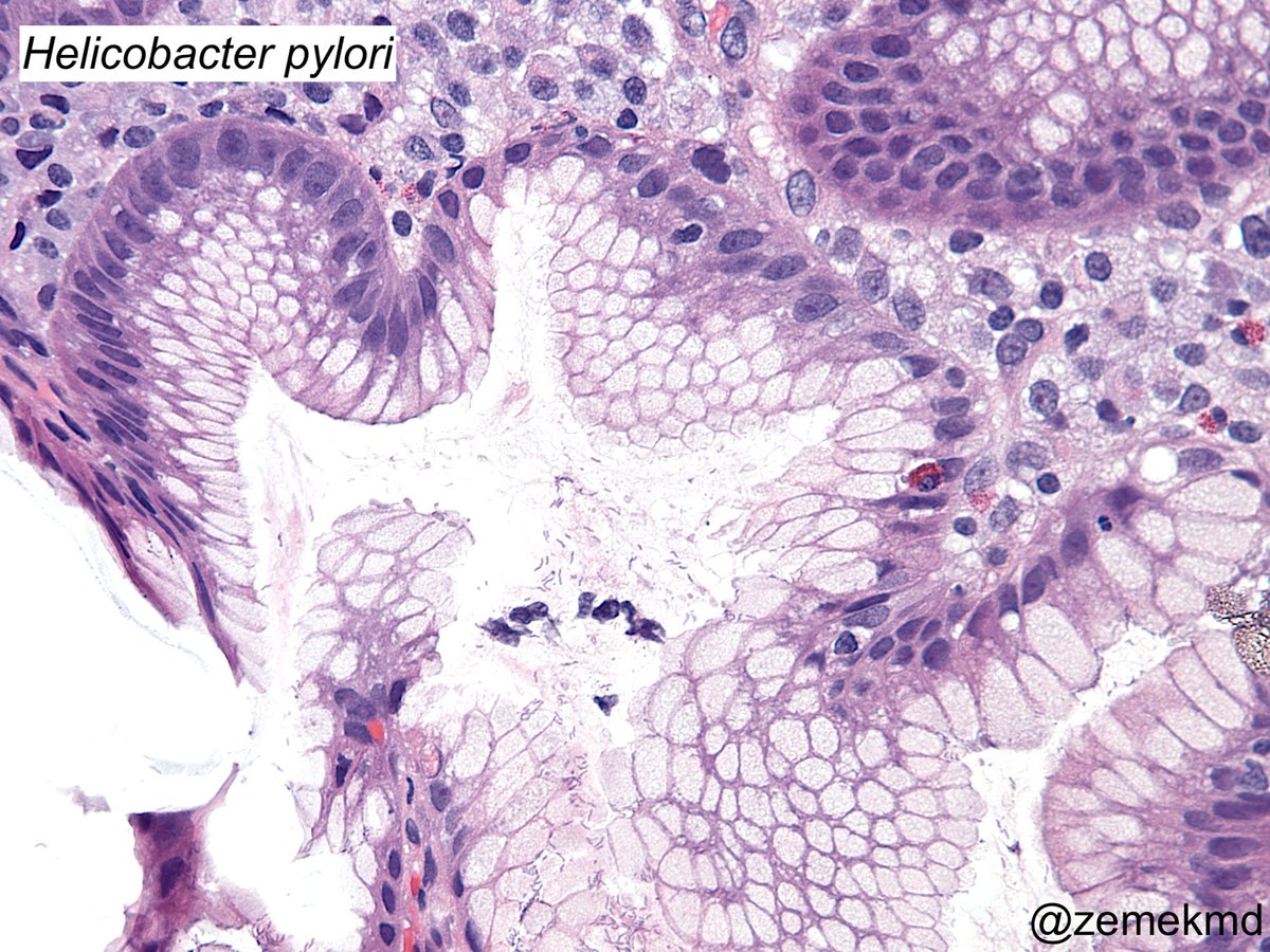 GI/Liver Path tweet media