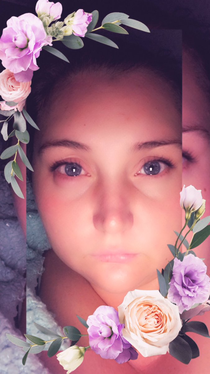 No filter is going to cover up this fat eye 😭 internal Sty isn’t not a good look 👀. Oh well 12 days off to spend with the little man a spoil him for his birthday 🥰💙