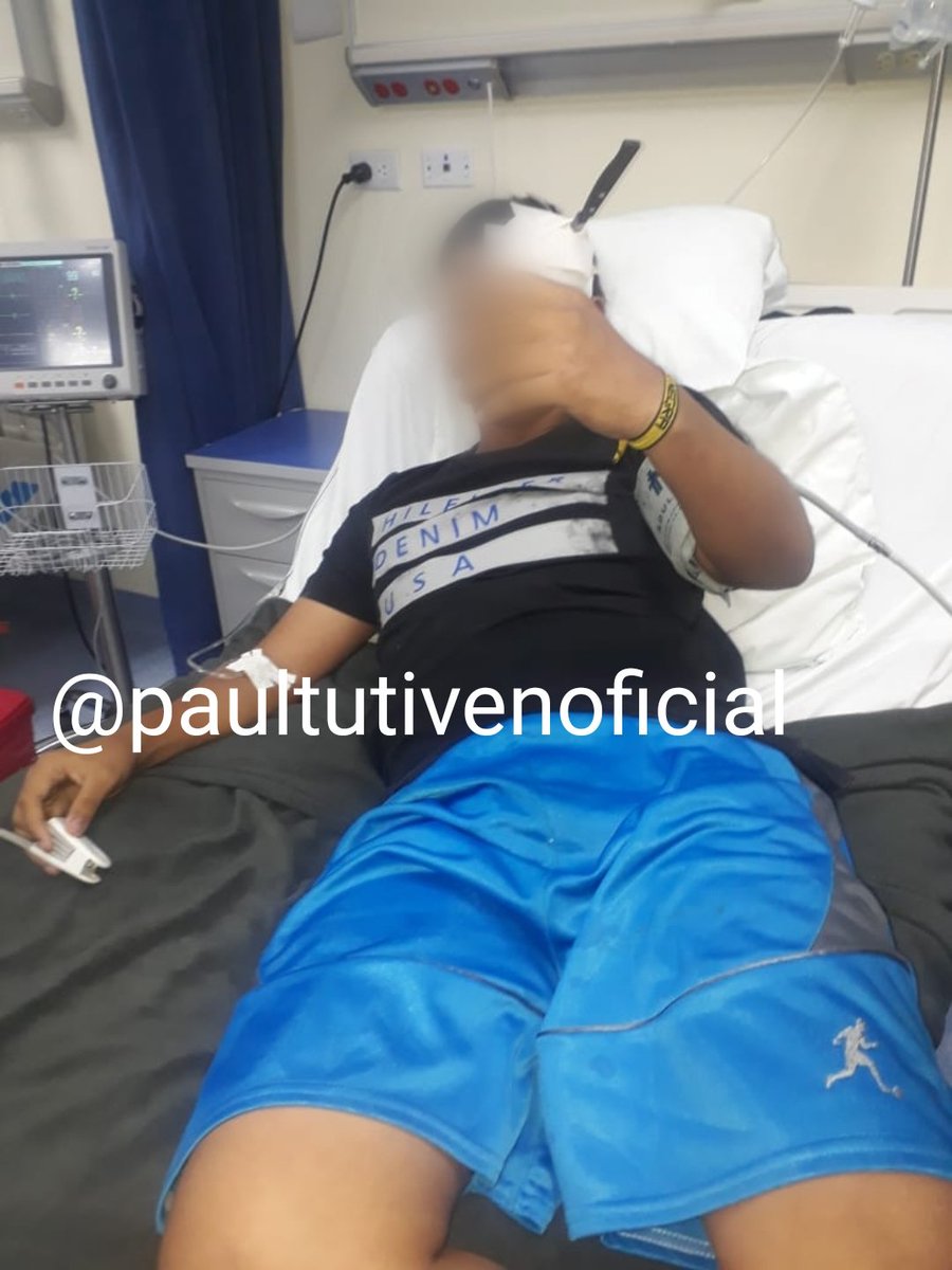 LE CLAVARON EL CUCHILLO EN LA CABEZA POR NO DEJARSE ROBAR
La victima un adolescente de 17años. Los delincuentes como no lograron robarle, lo atacaron y escaparon. El menor fue llevado a un hospital. Ocurrió en Bastión Popular, norte de Guayaquil. <a href="/teleamazonasec/">Teleamazonas</a> @24HorasGYE