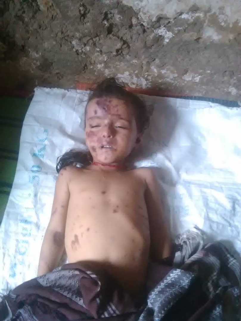 فريق الكوارث التابع لجمعية الهلال الاحمر  . يواصل انتشال الجثث من تحت الانقاض في ملحان م/ المحويت نتيجه هطول  الامطار وتدفق السيول يوم امس  تسببت بوفاة تسعه وانهيارات صخريه وانفجار  27  حاجز  مياه و اضرار بالغة بالممتلكات وقطع الطرق  وتهدم منازل 
ندعوا المنظمات التحرك في الاغاثة