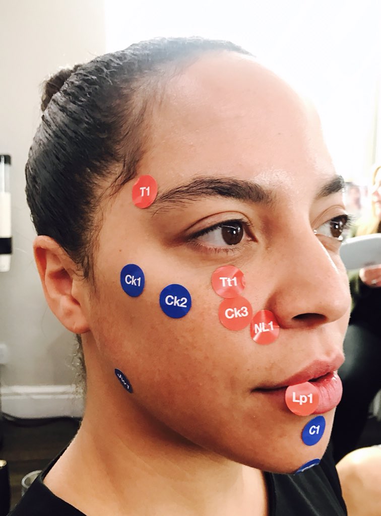 MissBalaratnam's tweet photo. #ThrowbackThursday to our #BeautyDecoded local #Beaconsfield event in May where we demystified the science and potential on how #facial #fillers work using the latest #MDCodes #education #medical #aesthetics #Juvedermit #Juvederm #naturalresults #Buckinghamshire @Allergan https://t.co/im9RtkT0tQ