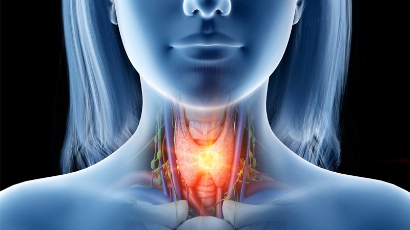 Medscape's tweet photo. Head and Neck Mucosal Melanomas clinical reference. https://t.co/ISu38dpWUT https://t.co/rUctKci8Bc