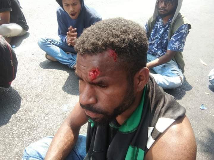 FreeWestPapua's tweet image. BREAKING: 5 #WestPapuan activists seriously injured and one "disappeared" for demonstrating in #Malang, calling on #PacificIslandsForum (#PIF) leaders to support #WestPapua's right to #selfdetermination.  Where is #NikoJigibalom? He was disappeared by #IndonesianPolice ##PIF2019