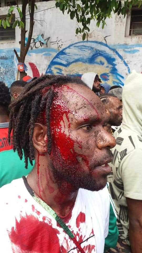 FreeWestPapua's tweet image. BREAKING: 5 #WestPapuan activists seriously injured and one "disappeared" for demonstrating in #Malang, calling on #PacificIslandsForum (#PIF) leaders to support #WestPapua's right to #selfdetermination.  Where is #NikoJigibalom? He was disappeared by #IndonesianPolice ##PIF2019