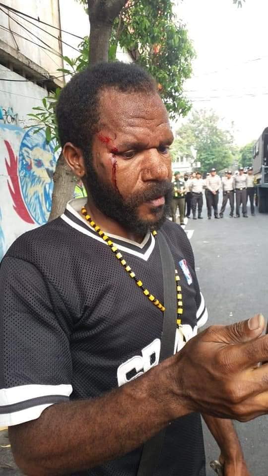 FreeWestPapua's tweet image. BREAKING: 5 #WestPapuan activists seriously injured and one "disappeared" for demonstrating in #Malang, calling on #PacificIslandsForum (#PIF) leaders to support #WestPapua's right to #selfdetermination.  Where is #NikoJigibalom? He was disappeared by #IndonesianPolice ##PIF2019
